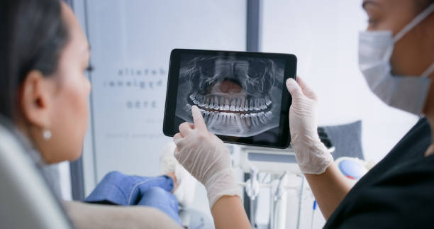 Licensed Wisdom Tooth Removal service in Ogden, UT - Smile Center Dentistry